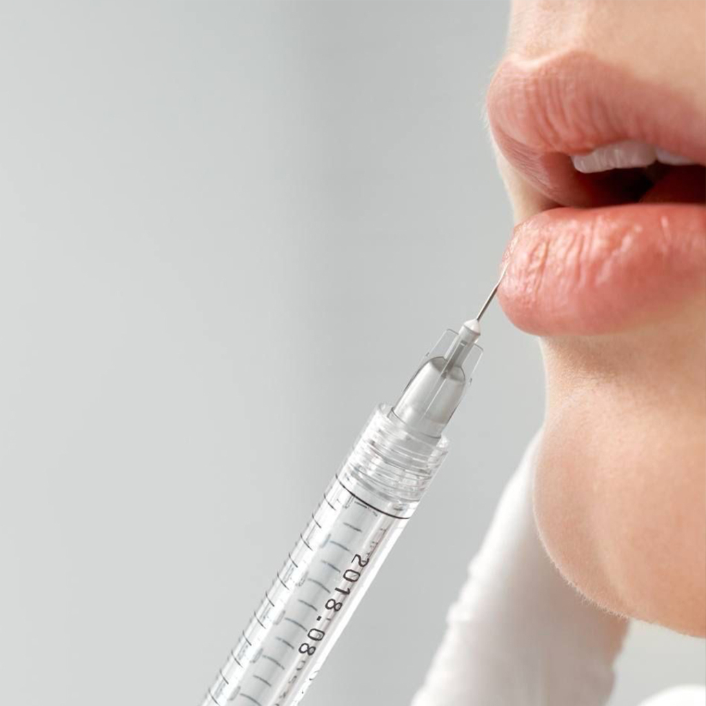 Dermal Filler Dissolving