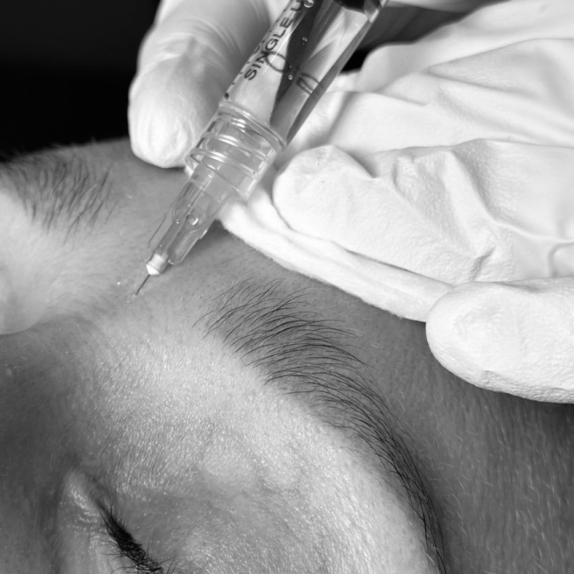 Anti Wrinkle Injections