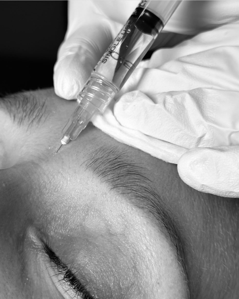 Anti Wrinkle Injections