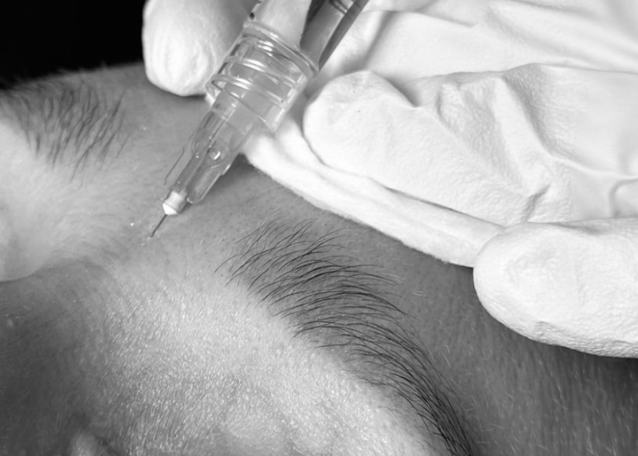 Anti Wrinkle Injections