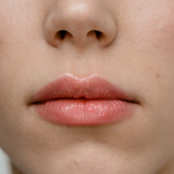 Thin Lips