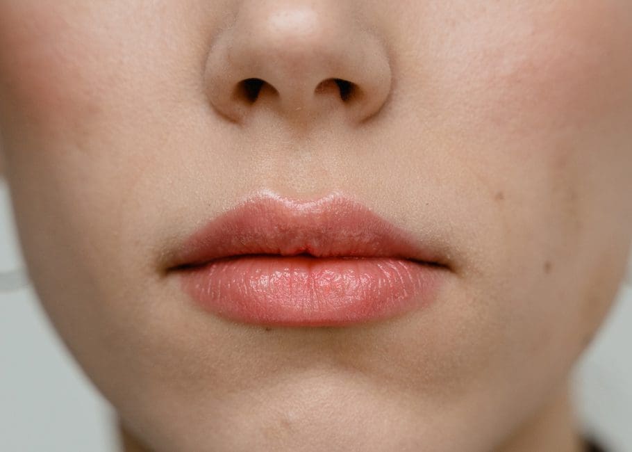 Thin Lips